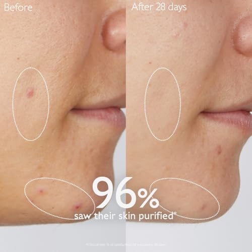 Alternative view of Caudalie Vinopure Temizleyici Temizleme Jeli, Salisilik Asitli - 150 ml